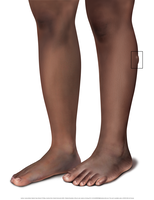 Medical Illustrations of a Buruli ulcer - SET 2