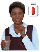 Medical Illustration of Buruli ulcer - SET 3